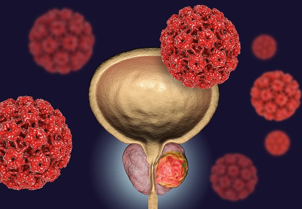 Imagem da Prevenção do Cancro da Próstata
