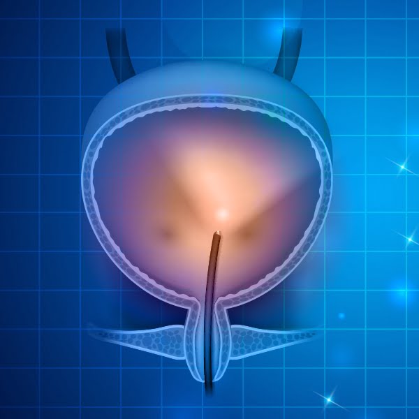 endoscopy-bladder